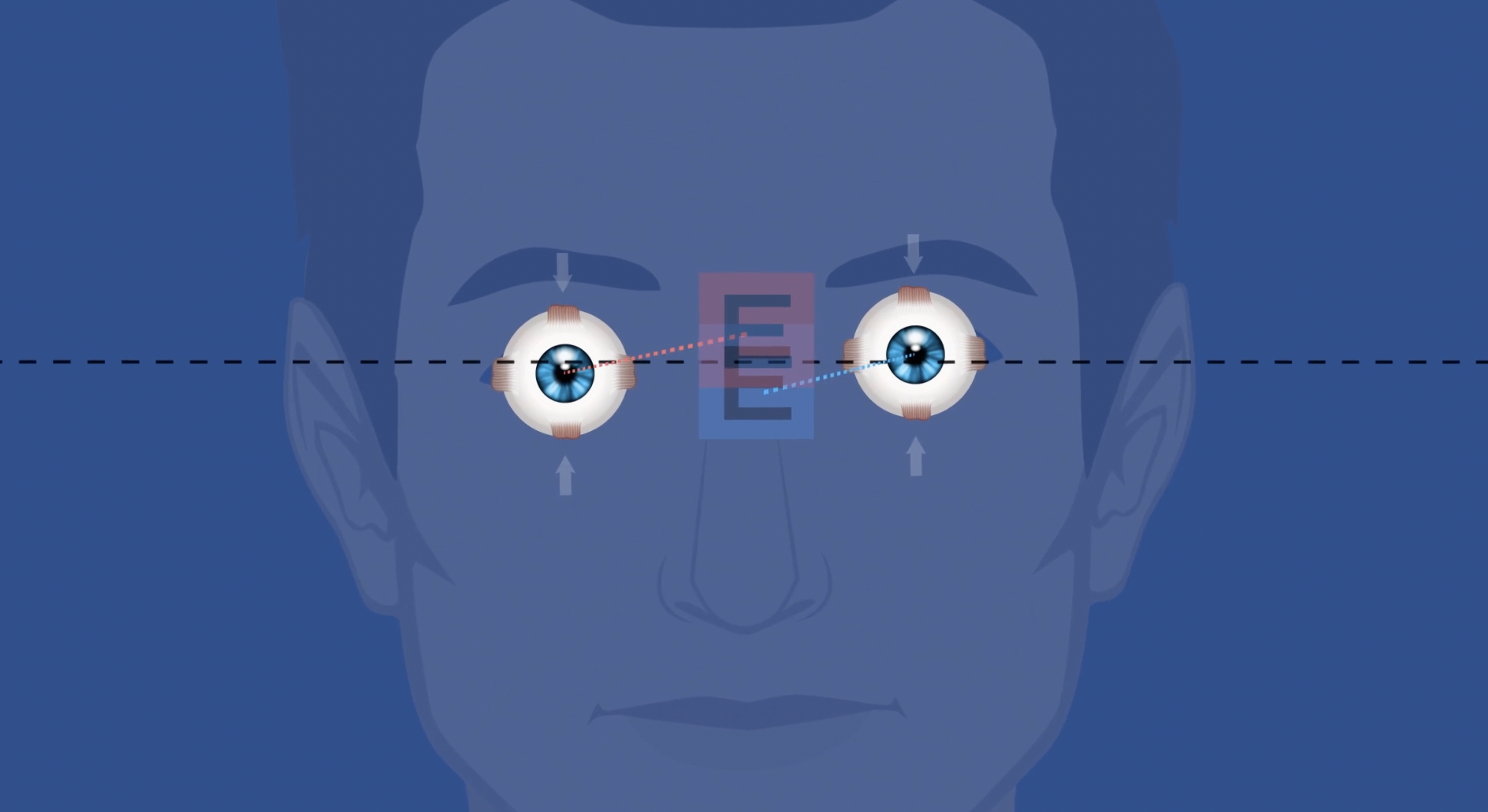 An eye diagram from NVMI.